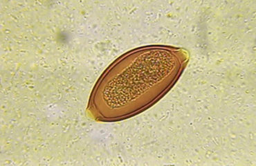 As larvas fracassam na Doença de Crohn